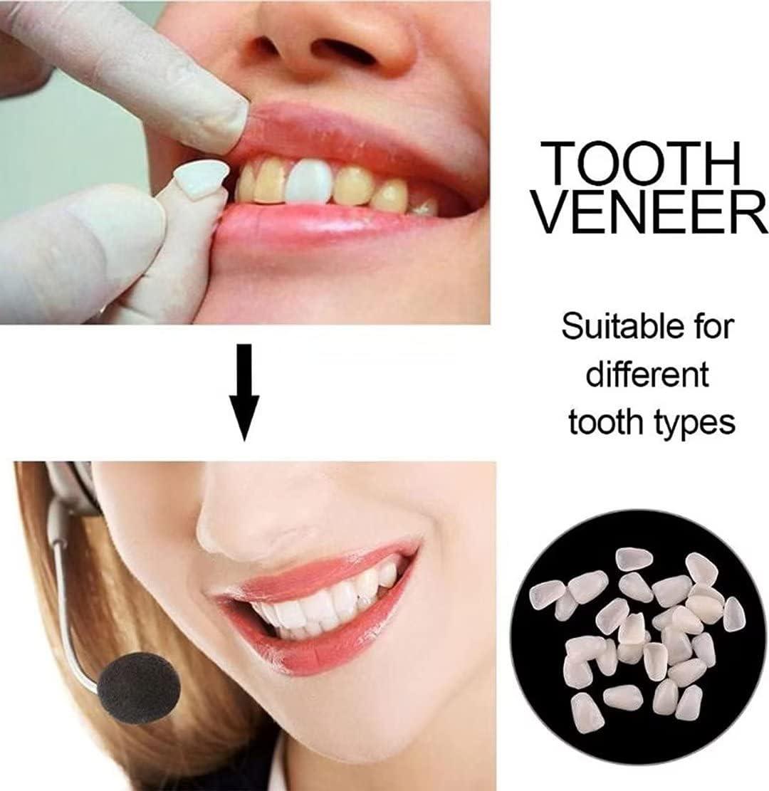 womcare Fake Tooth Repair Kits DIY Dental Care Kit Glue for Filling Missing Broken Teeth Crowns and Bridges Moldable Fake Teeth to Regain Your Beautiful Smile in Minutes-White Color