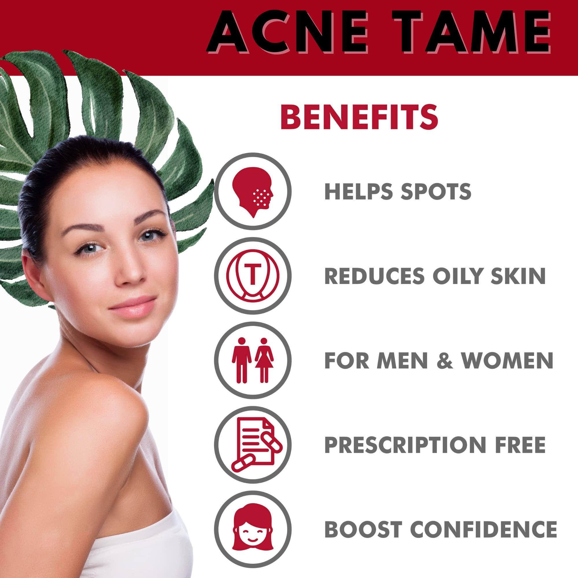 Acnetame Acne Tame 2 Pack- Clear Skin Supplements Pill- Tablets for Oily Skin Treatment, Spots, Blemishes, & Sebum Control for Women, Men, & Teens…