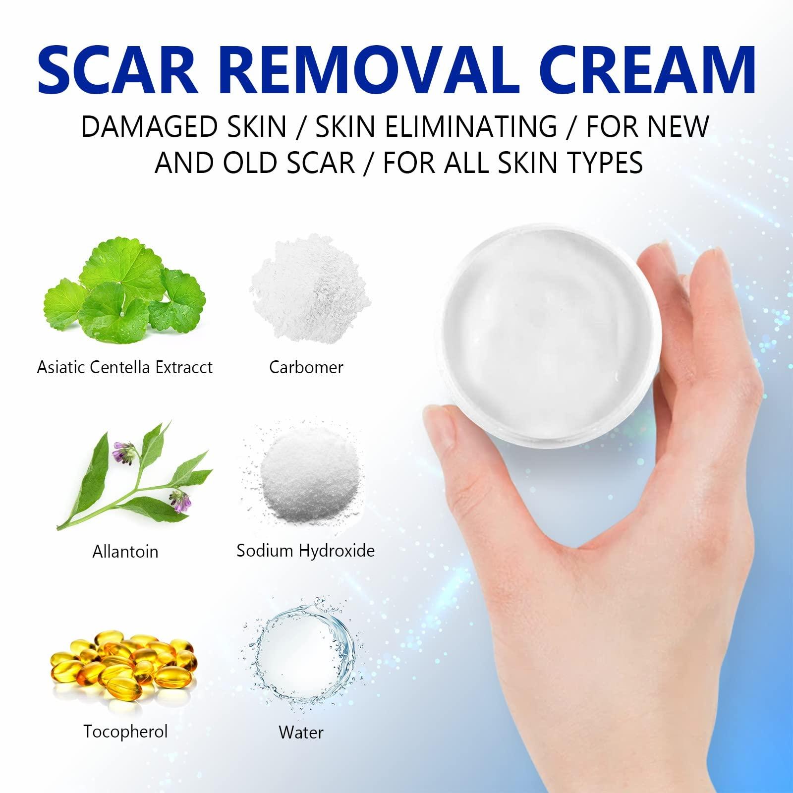 SBHEANGBA Scar Cream, Scar Removal Cream - Advanced Scar Cream for Surgical Scars, Acne Scars, C-Section, Burns, Stretch Marks -Effective for Old and New Scars Gel Acne Scar Treatment