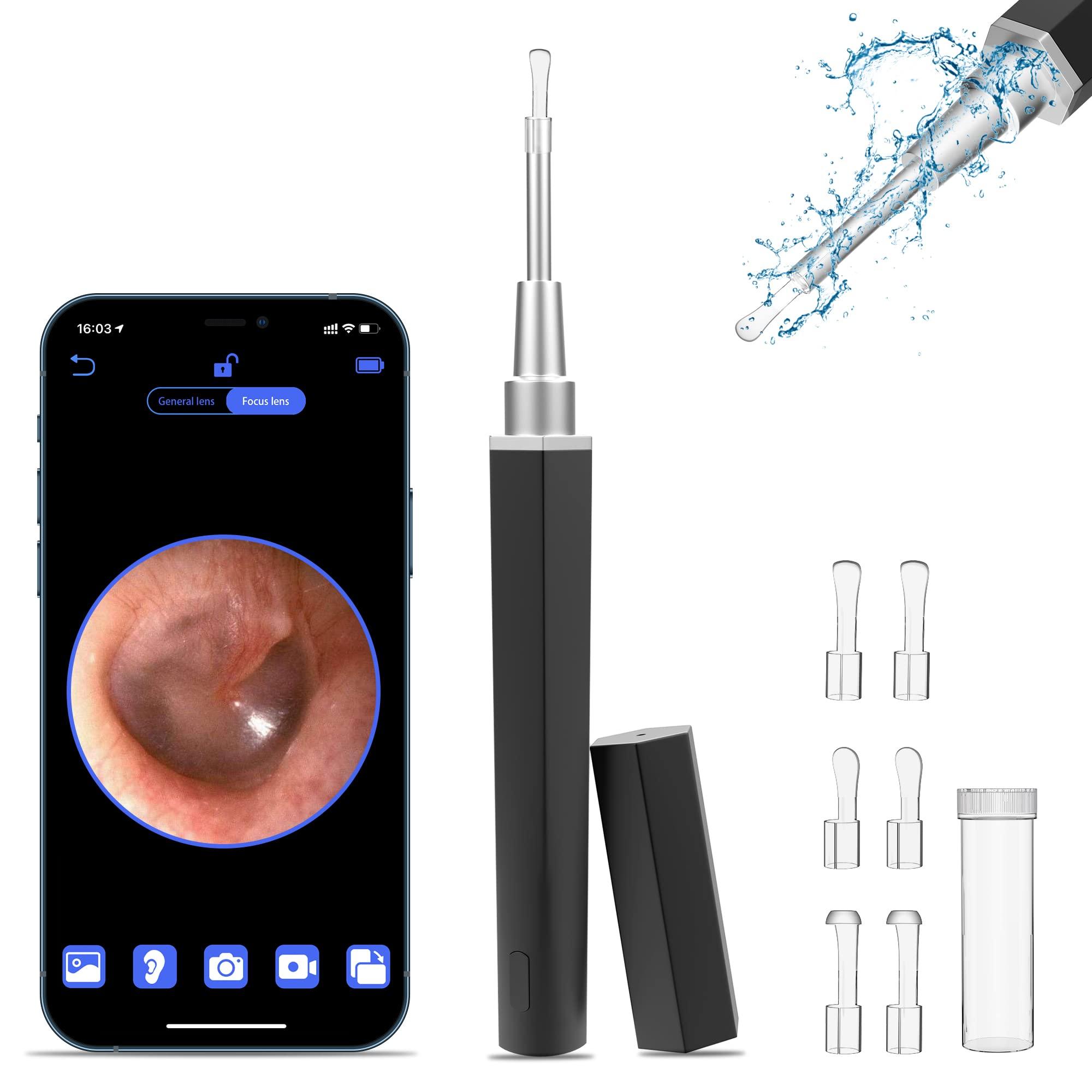 VANBAR Ear Wax Removal, Ear Cleaner with Camera Earwax Remover Tool, Ear Camera Otoscope kit with Light, Ear Wax Camera with 6 Ear Spoon for Kids, Adults & Pets