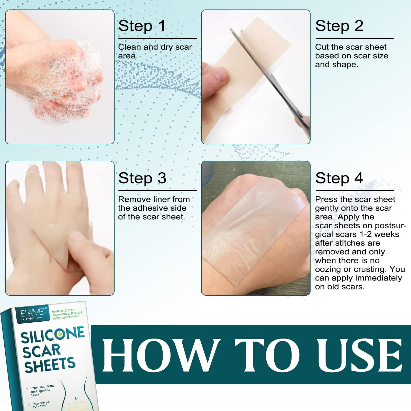 RTBYUE Silicone Scar Sheets,Professional Silicone Tape for Scars(16 pads-5.9x 1.6),Silicone Scar Tape,Scar Removal Sheets,Silicone Scar Strips for Surgical Scars, C-Section, Surgery, Burn, Keloid, Acne