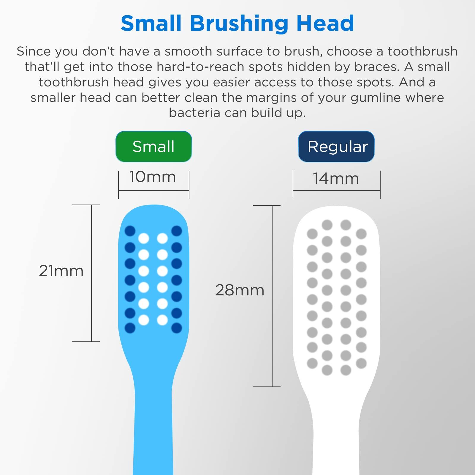 Fremouth Fremouth V-Shaped Orthodontic Toothbrush for Braces, Soft Bristles, 6 Count