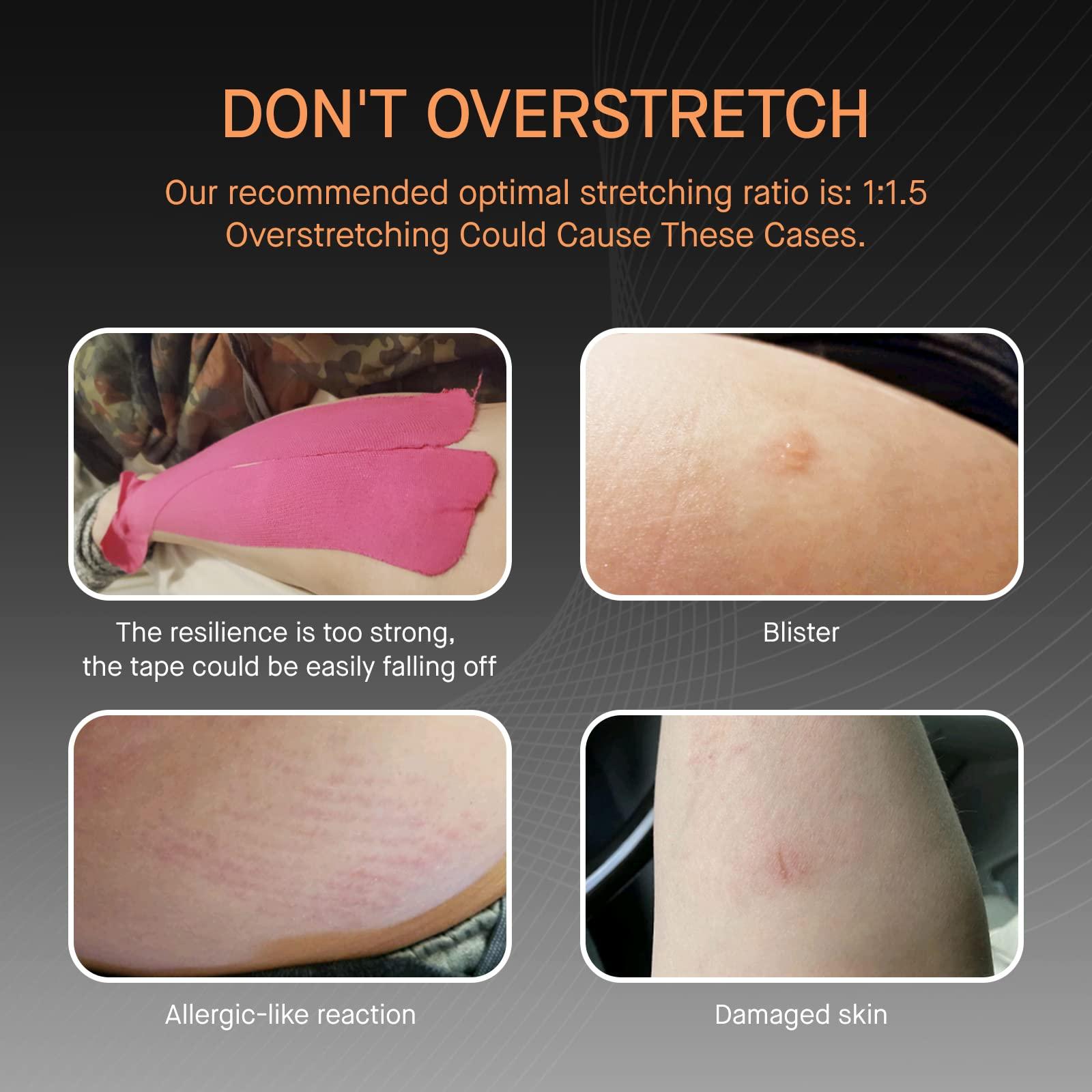 OK TAPE OK TAPE Kinesiology Tape, Basic Original Cotton Elastic Athletic Tape for Support and Recovery, Sports Tape Therapeutic Pain Relief, 2in16.4ft Uncut Roll - Pink