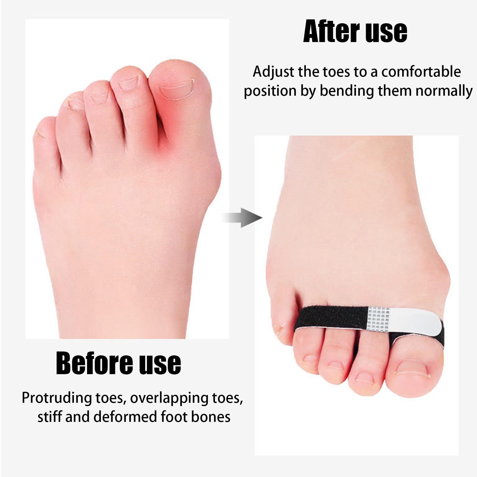 HNYG HNYG 10 Pack Finger Buddy Straps,Buddy Tape Finger Wraps,No-Slip Buddy Loops Finger Splints for Sprained,Fractured and Injured Fingers,Reusable and Washable