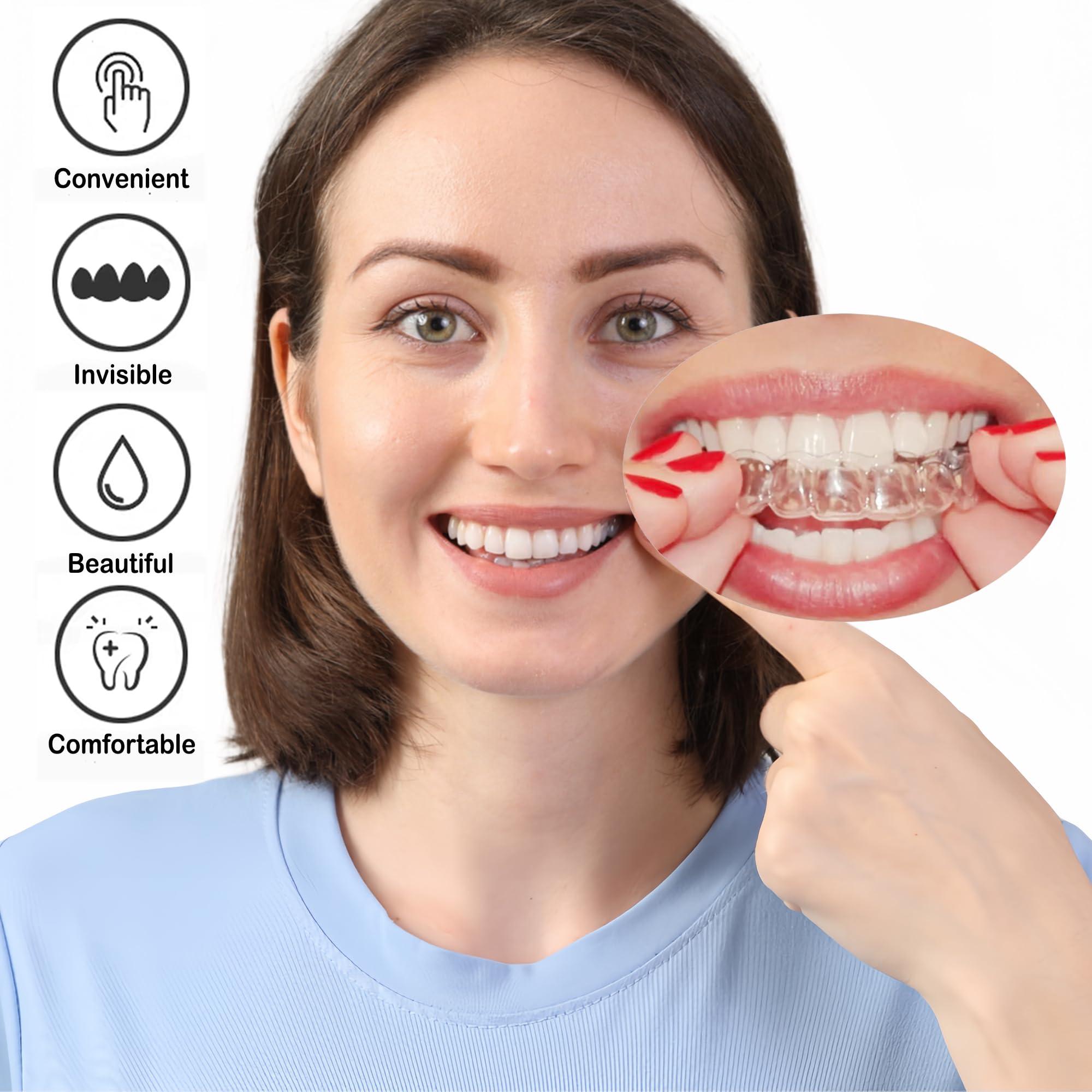 Candyying Custom Dental Night Guard, Custom Mouth Teeth Guards Against Teeth Grinding/Clenching Dental Retainer for TMJ Relief and Bruxism (One Lower Guard)