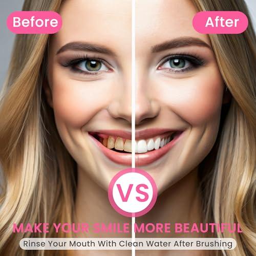 BodyAccel BodyAccel Niacinamide Whitening Toothpaste, BodyAccel Toothpaste, Niacinamide Intensive Whitening Toothpaste, Niacinamide Toothpaste, Stain Removal Toothpaste Natural, Fresh Breath (2)