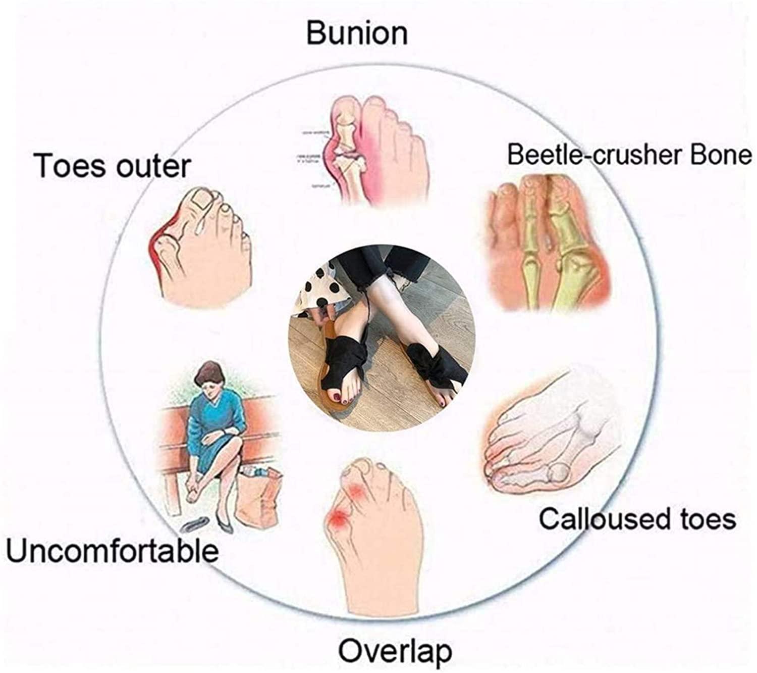 Ralsko Open Toe Sandal with Arch Support,Women Orthopedic Bunion Corrector,Casual PU Leather Big Toe Correction Sandals,for Beach Travel Summer,Khaki,39