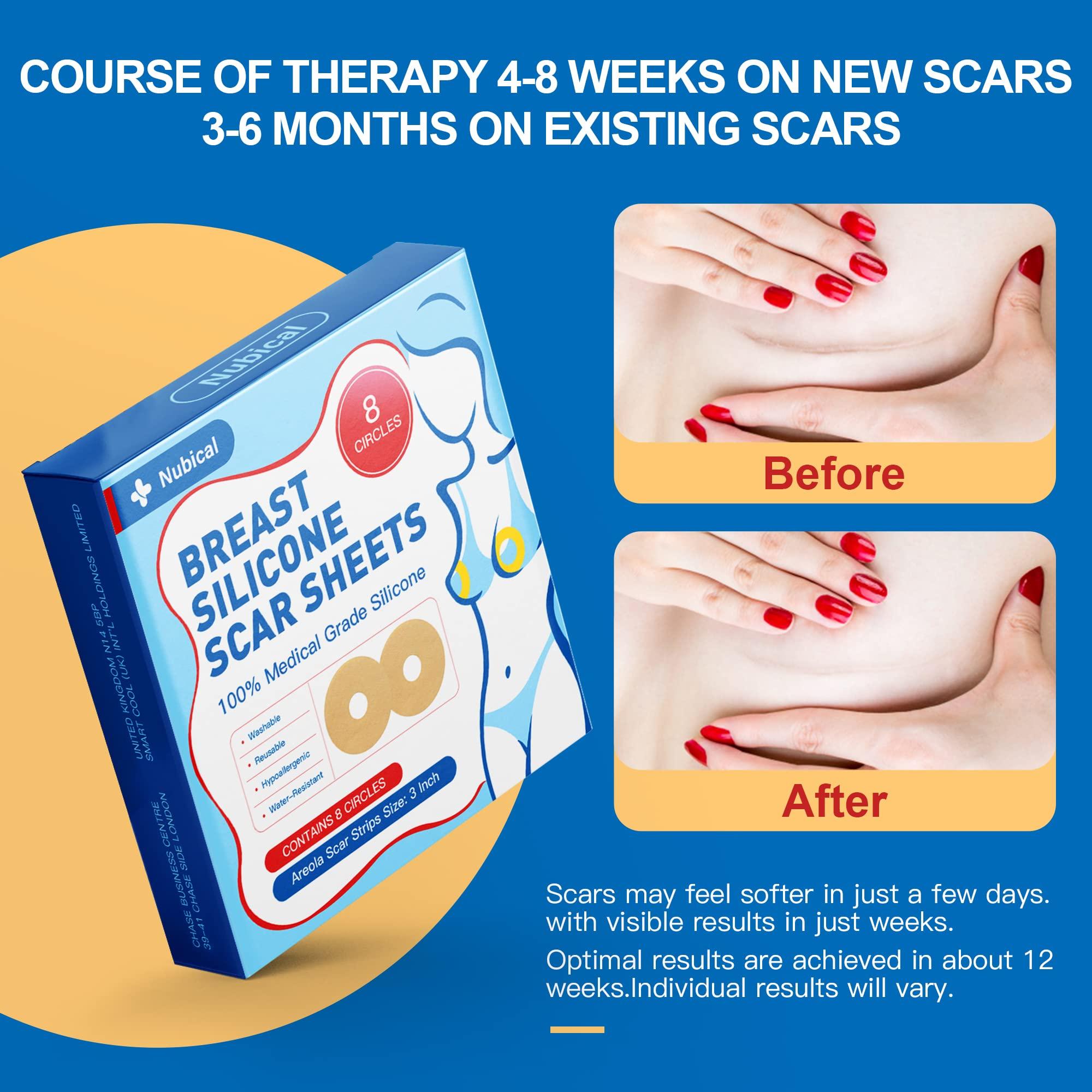 Nubical Medical Silicone Scar Sheets 8 Pack, Breast Scar Treatment After Surgery, Post Surgery Supplies Scar Removal SheetsBreast Reduction After Surgery for Scars