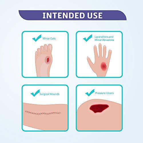 Conkote Conkote Hydrocolloid Wound Dressing 4”x 4”, Sterile Adhesive Patches, Box of 10 Dressings