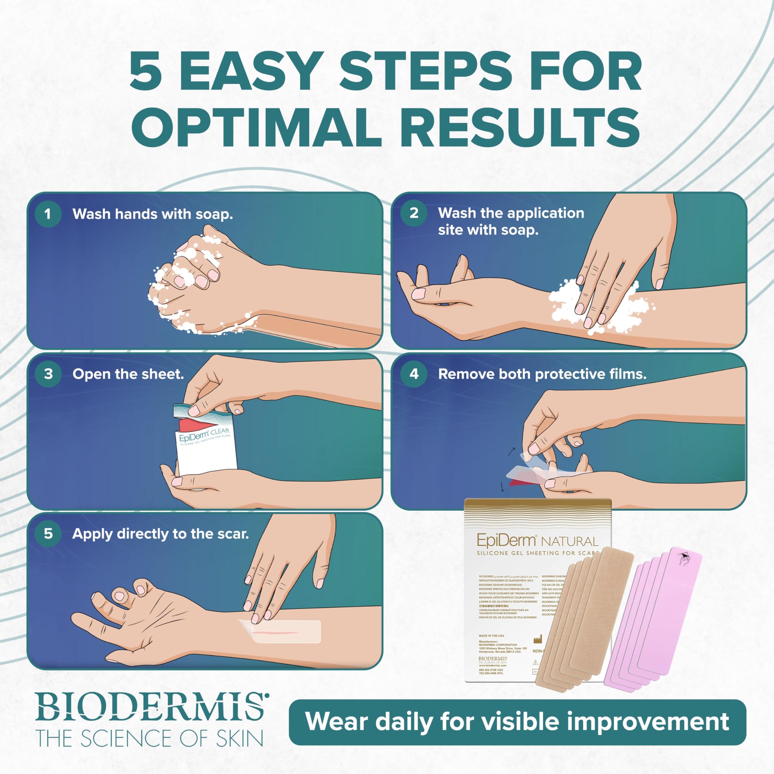 BIODERMIS Epiderm Silicone Gel Scar Sheets - Premium-Grade Silicone Scar Sheets for Optimal Scar Care - Versatile, Flexible & Reusable - Ideal for C-Section, Tummy Tuck & Hysterectomy Scars - 1.4x6 in, Natural