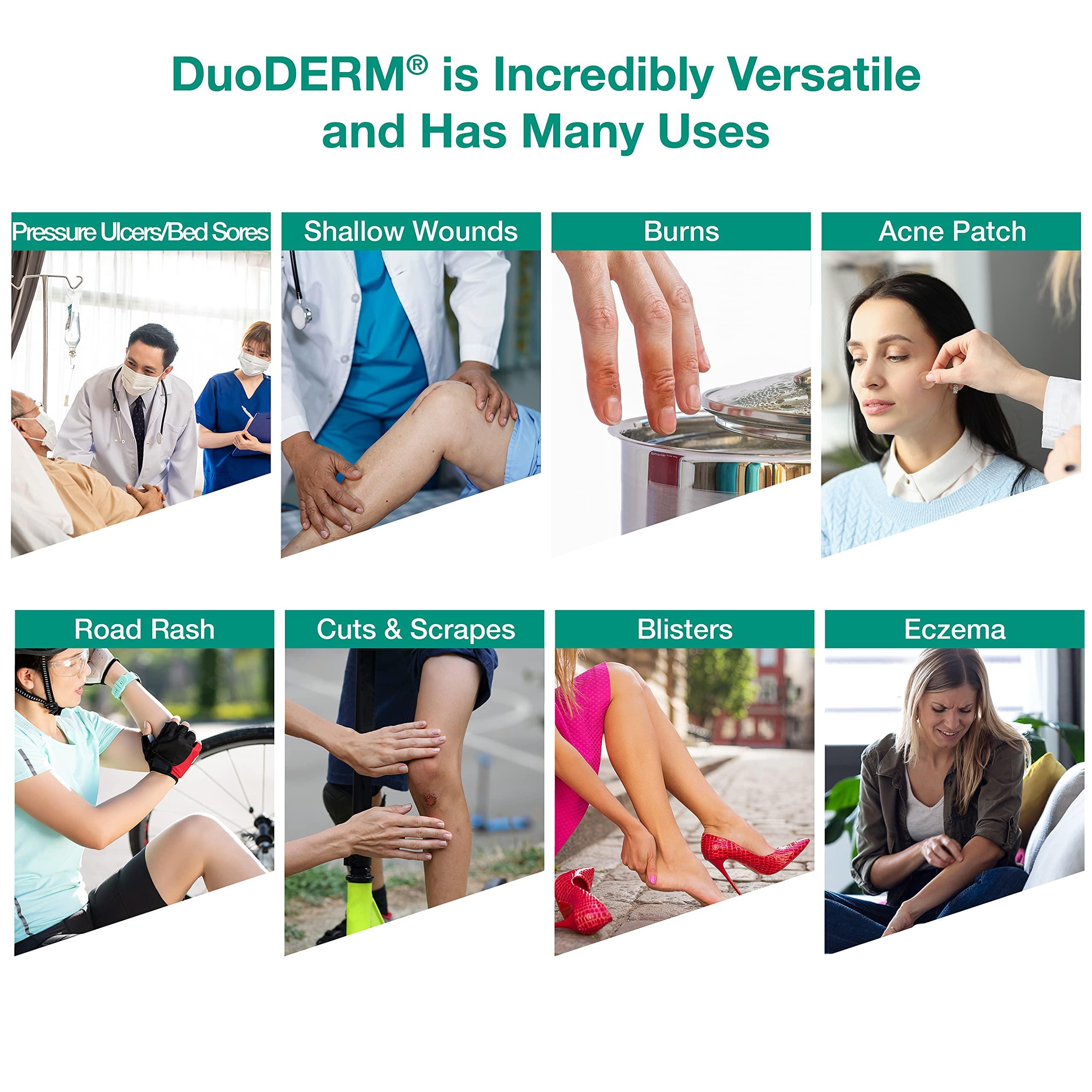 ConvaTec ConvaTec DuoDERM Signal CGF 4\"x4\" Hydrocolloid Tapered Edge Sterile Adhesive Dressing with Change Indicator for Exuding Wounds, Waterproof, Latex-Free, Flexible, Square, Beige, 5ct Box