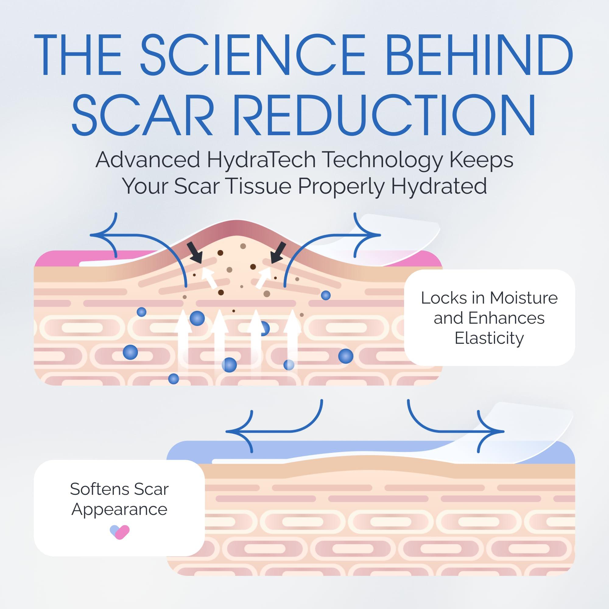 ScarScience ScarScience C-Section Recovery Kit - Advanced Scar Treatment after C-Section - Medical Grade Waterproof Silicone Scar Sheets for Scar Removal, 8 Strips + Silicone Gel for Scars and Surgical Scars,18ml