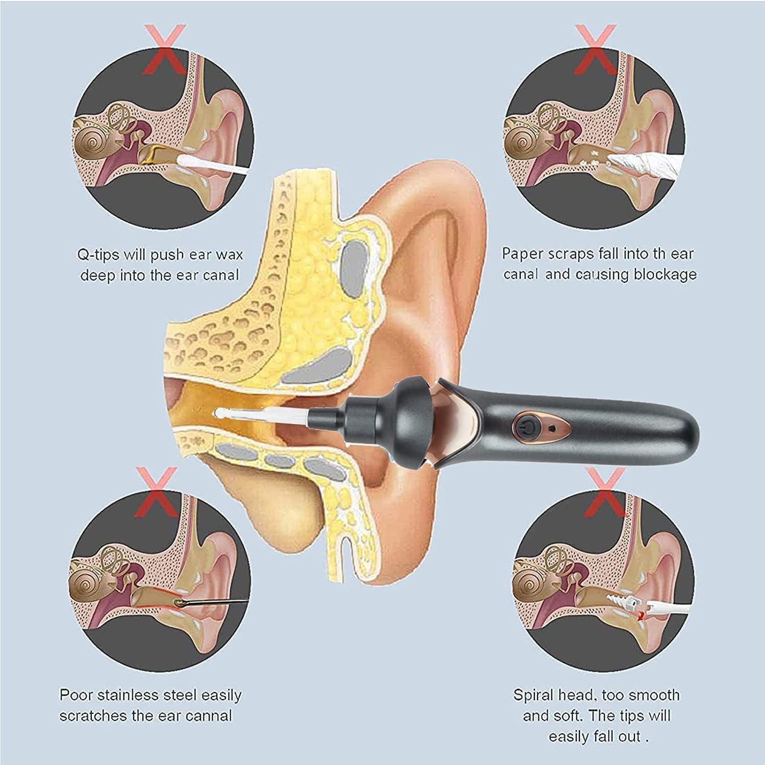 VEGIONE VEGIONE Ear Wax Remover Vacuum Cleaner Ear Wax Removal Painless Cleaning Tool, Ear Cleaning Device for Adults and Kids for Earwax with Light,White