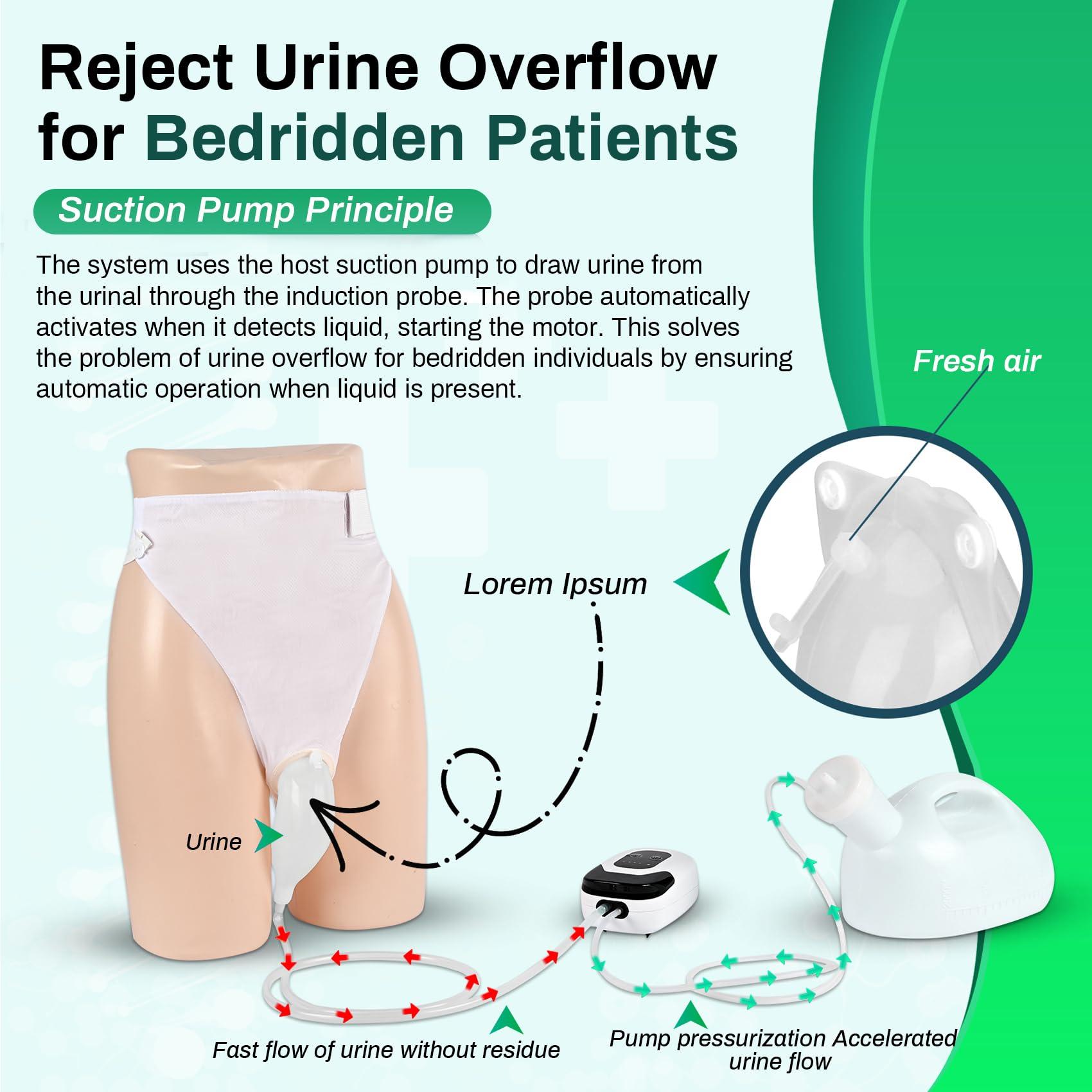 Joogto 2025 Upgrade Female Electric Urinal - Automatic Start-Stop Dispenser, 2000ML Capacity with 6.5 ft Catheter, Bed Rest Anti-Leakage Design, Easy-to-Clean, Unisex, with Lid Funnel