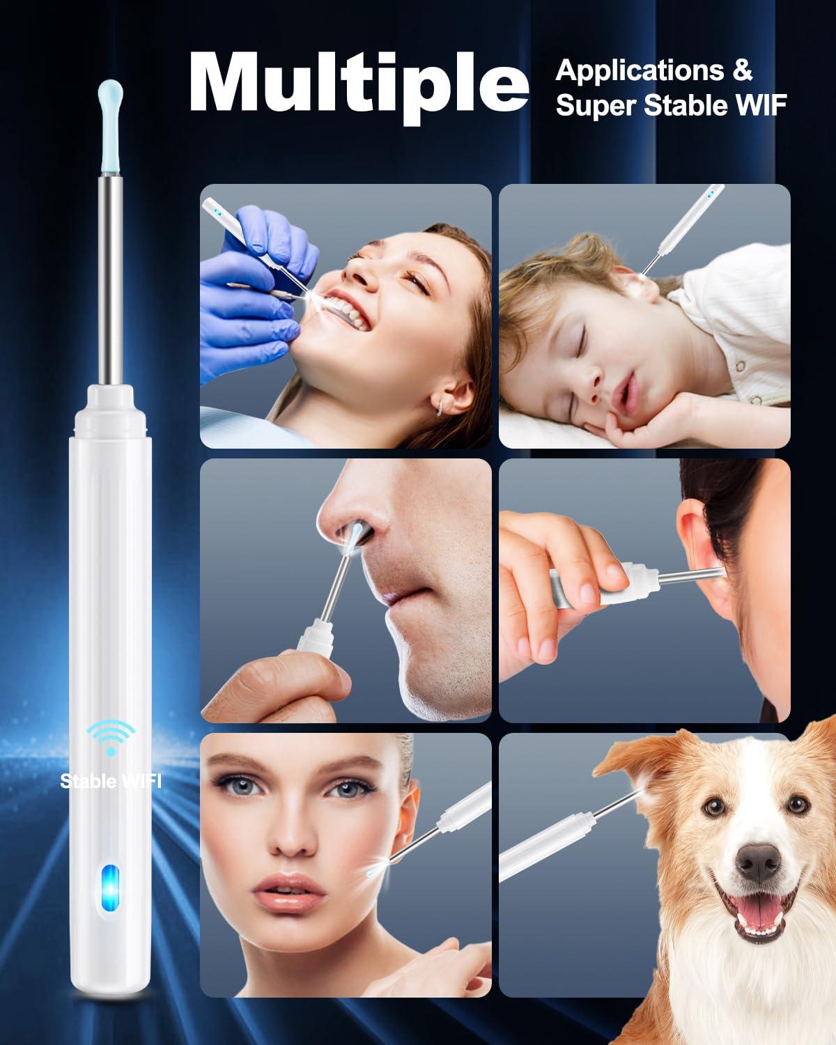 HaYiue Ear Wax Removal Tool Camera, Ear Cleaner with Camera, Ear Cleaning Kit 1296P HD Ear Scope, 6 LED Lights and 6 Ear Picks, Earwax Removal with Otoscope to Earify Earwax for iOS and Android