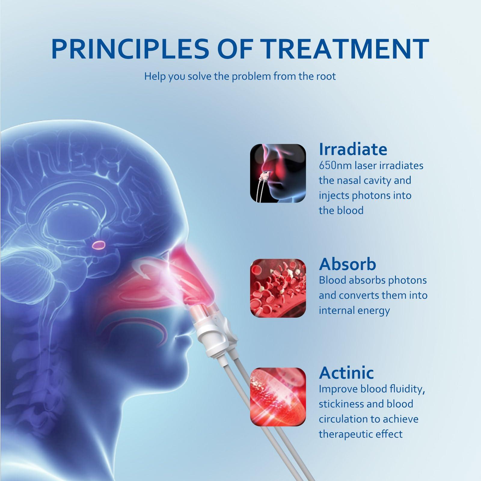 LASEPREHT LASEPREHT Red Light Nasal Therapy Device, 650nm Red Light Device for Nose Sore Throat, Upgraded Nasal Red Light Therapy Device for Runny Nose Allergy Relief Sneeze, Red Light Nose Treatment