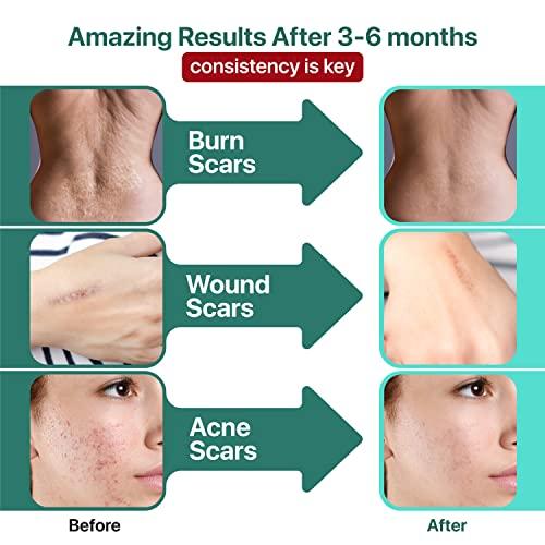Ebanel Laboratories Ebanel Bundle of Advanced Silicone Scar Gel 1 Oz, and 20% Vitamin C Serum