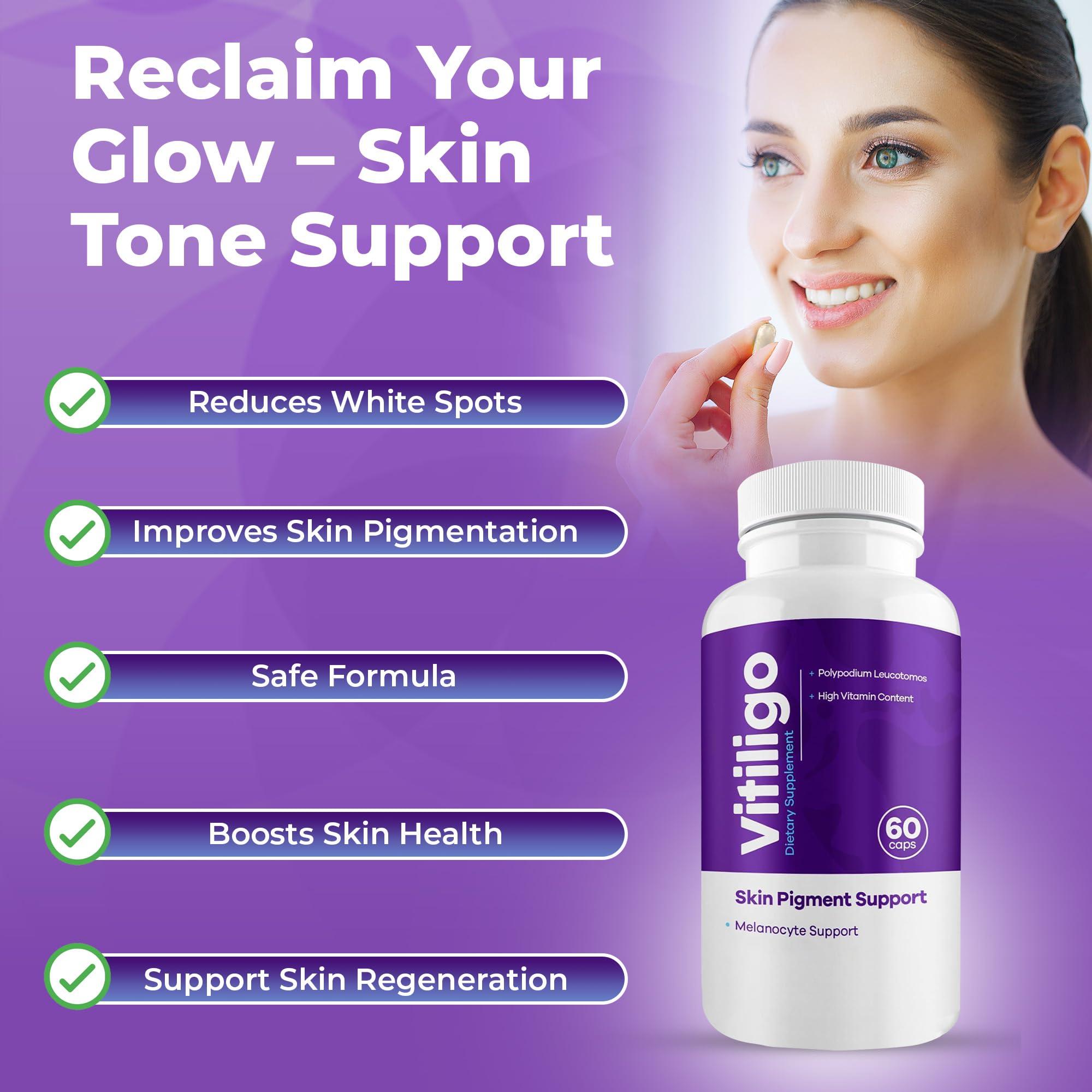 AURA VITAMINS AURA VITAMINS - Vitiligo Capsules 60 Count | 1 Month | Improve Skin Pigmentation Support and Reduce White Spots | Effective Vitiligo Supplement | Natural Solution for White Spots on Skin. (1)