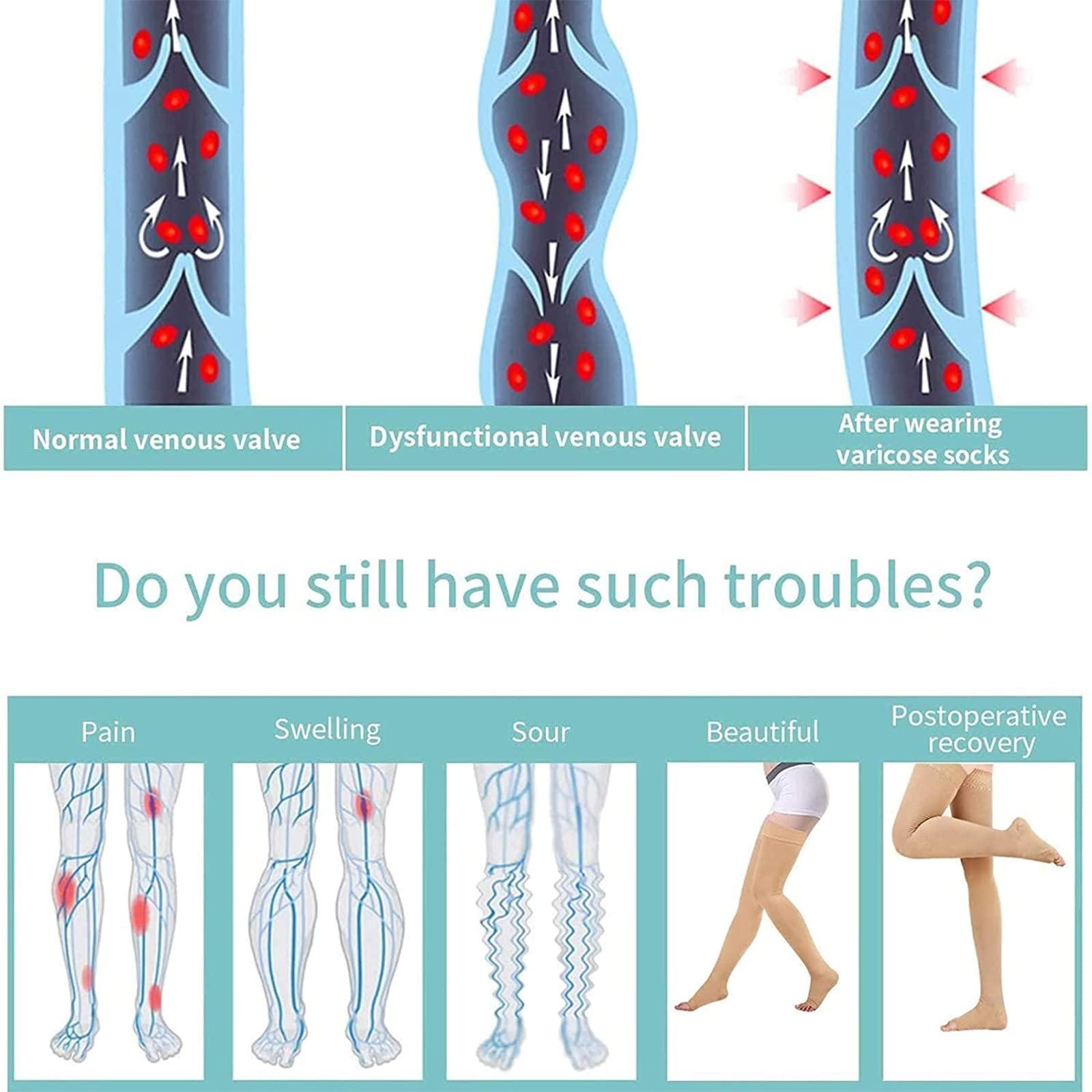 Athbavib Thigh High 20-32 mmHg Compression Stocking Toeless Compression Socks for women & men circulation with Silicone Dot Band