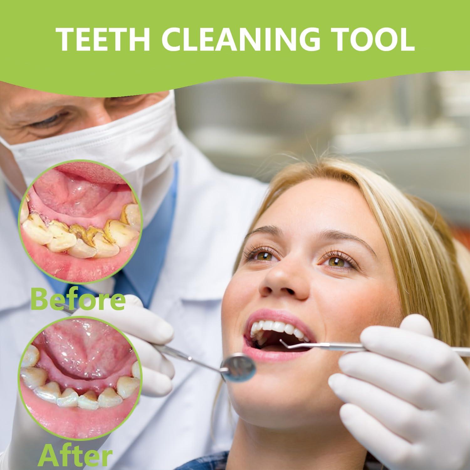 PARYUNGR PARYUNGR Dental Tools, Professional Teeth Cleaning Oral Care Hygiene Kit, Stainless Steel Dental Pick Tooth Scraper Tartar Plaque Remover for Dentist, Personal, Pet Use with Storage Box