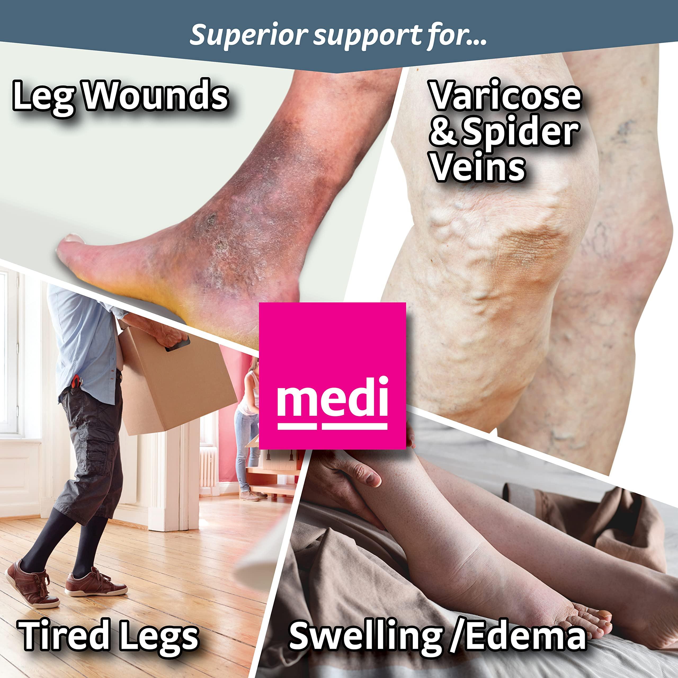 mediven mediven Plus for Men & Women, 20-30 mmHg - Open Toe, Knee High Compression Socks, Extra Wide II-Petite, Beige
