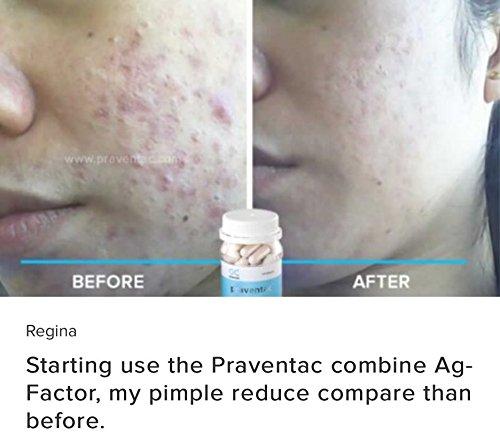 Onecare Wellness Praventac & Ag-Factor 1-month package Reduce Acne, Pimple, Blemishes, Treat Scar (1 bottle each/60 capsule per bottle)
