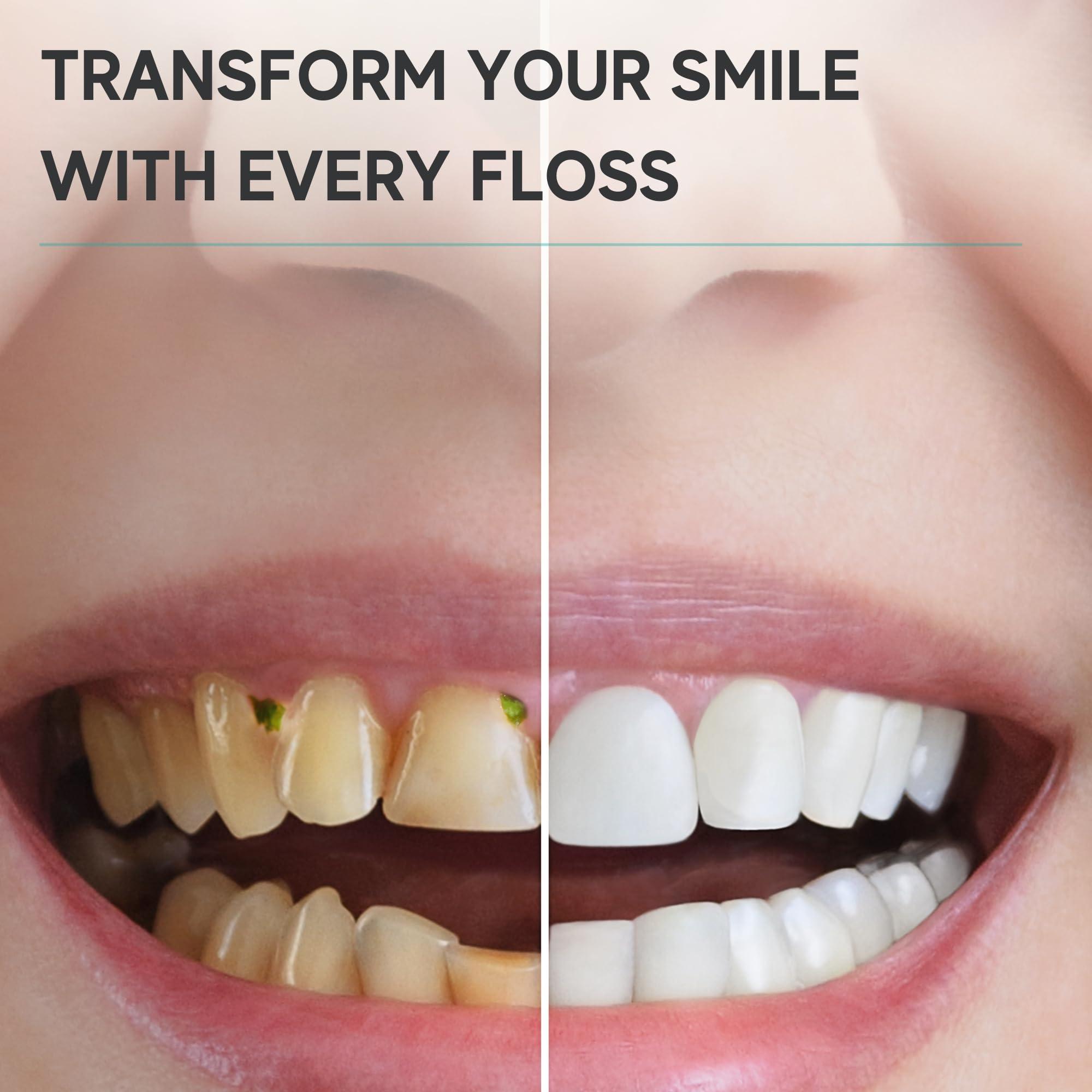 Avistar 150 Individually Wrapped Floss Picks - Pink Travel Floss Picks - Easy Grip Disposable Floss Picks - Dental Flossers for Teeth - Gently Removes Plaque & Food Particles Between Teeth