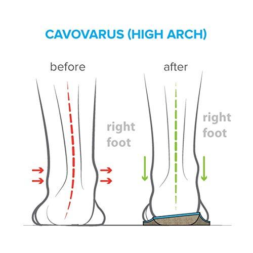 FootScientific FootScientific® Arches Type 3 (High Arch) Orthotic Shoe Insoles, Men’s Size 11-11.5 / Women’s Size 13-13.5
