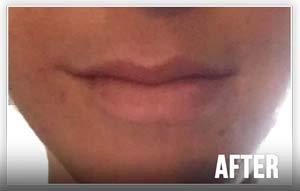 Quick Mend Quickmend Cold Sore Relief Lip Treatment with Pump Dispenser, 4.5 ml / .15 oz.