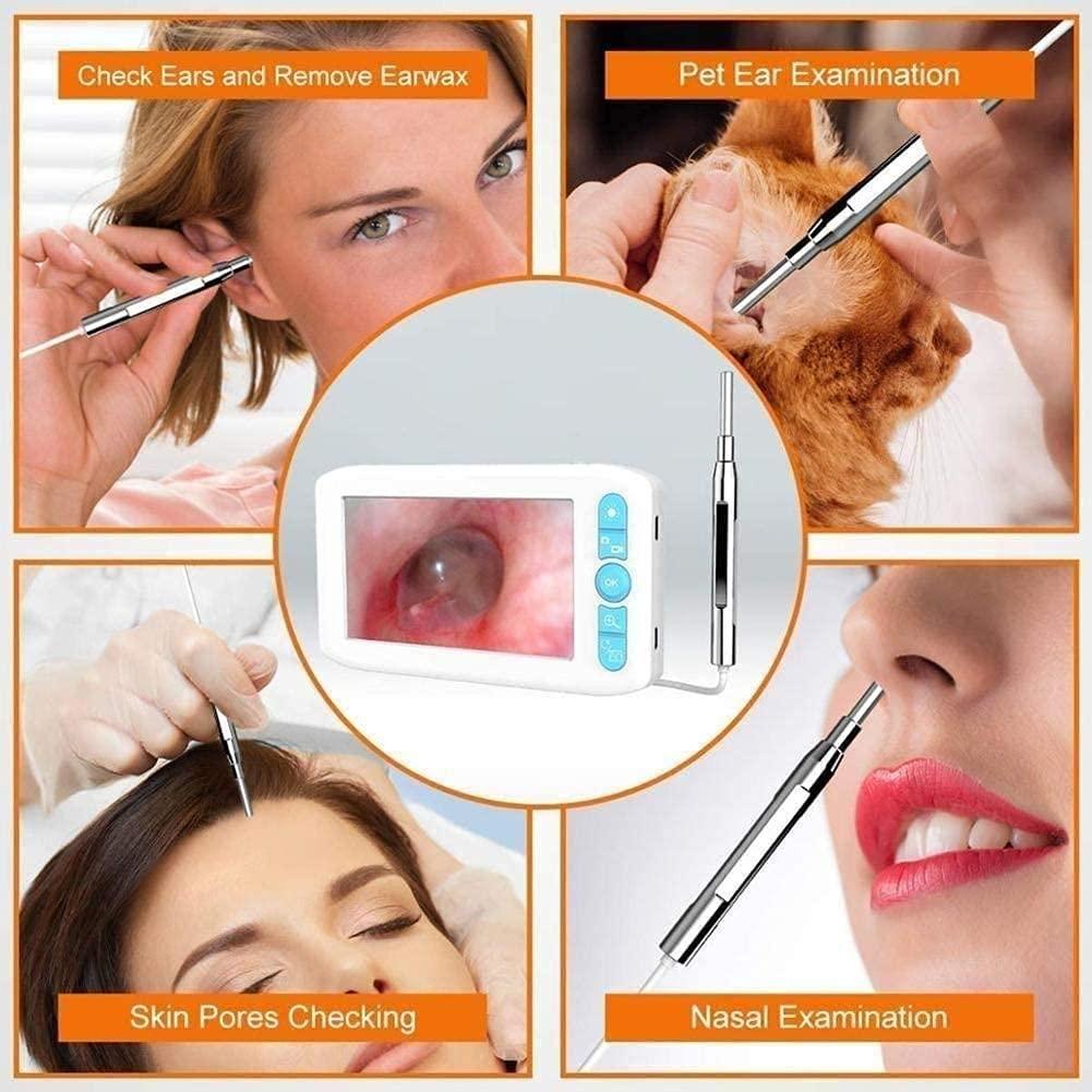QIYUDS QIYUDS Ear Wax Removal Endoscope,Ear Wax Removal Camera with 4.3\" IPS Screen, 1280x1080 FHD Smart Visual Ear Cleaner with Camera Tool Kit, Plug & Play at Home Ear Infection Detector Ear Wax Remover Ot