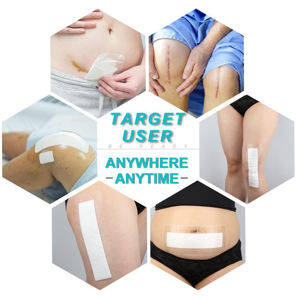 SinaiSea Large Waterproof Knee Replacement Surgery Adhesive Bandages Hip Surgery Shower Protector Cover Long Post Surgical Incision Wounds Island Dressing Bordered Gauze 4\"x12\" 25 Pack