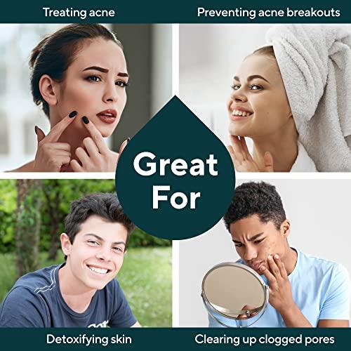 MARIE'S ORIGINAL Marie Originals Acne Bar Soap Cleanser for Face and Body | Acne Treatment with Bentonite Clay, Organic Oat Bran, Noni Fruit Powder, White Willow | Natural Body Wash for Pimples and Scars (1 Pack)