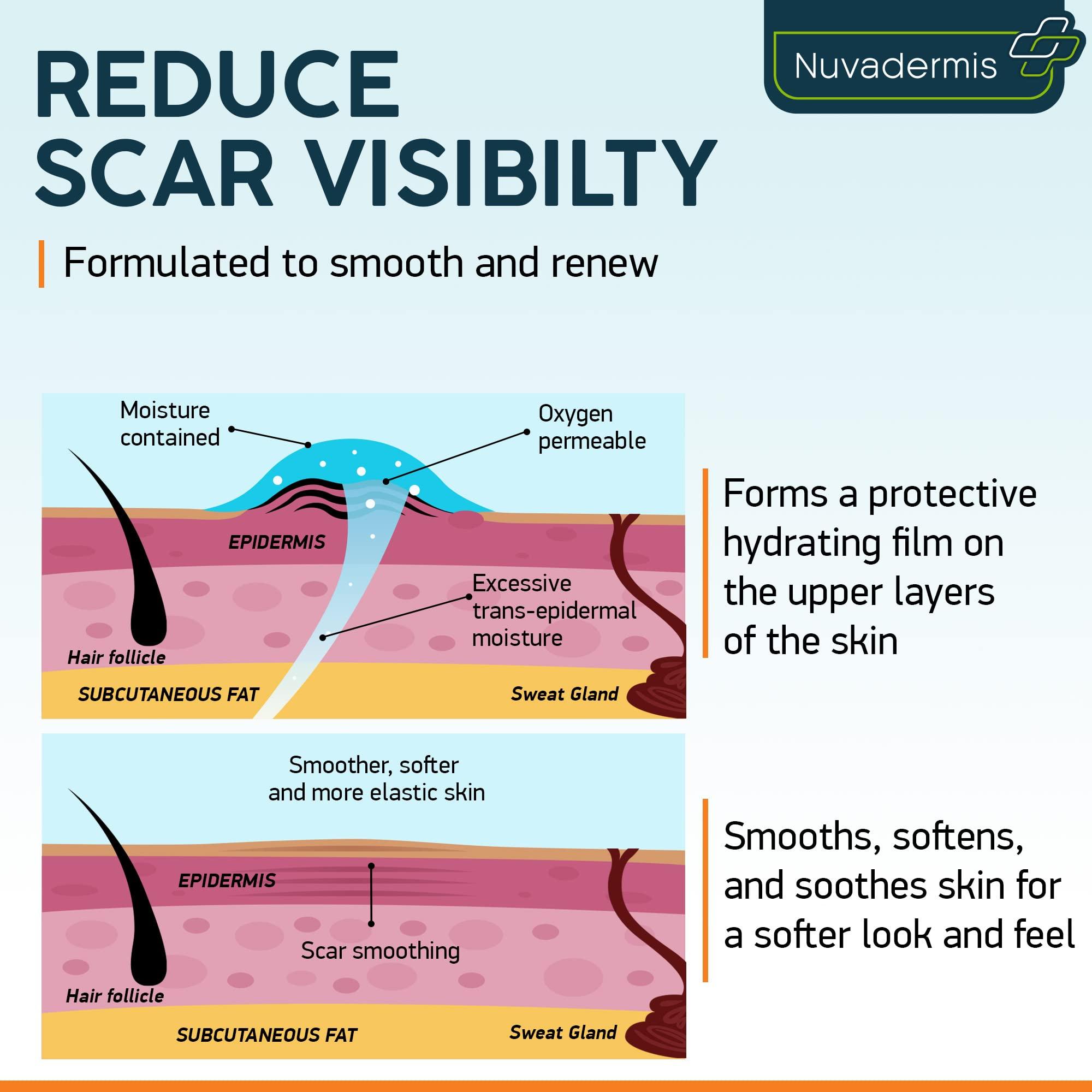 NUVADERMIS NUVADERMIS Silicone Scar Sheets & Scar Cream Gel - C-Section, Tummy Tuck, Keloid, Acne Removal Treatment - Advanced Post Surgery Supplies - Scars Removal Treatment