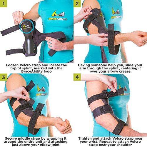 BraceAbility BraceAbility Cubital Tunnel Syndrome Elbow Brace | Splint to Treat Pain from Ulnar Nerve Entrapment, Hyperextended Elbow Prevention and Post Surgery Arm Immobilizer - M (MEDIUM/LARGE)