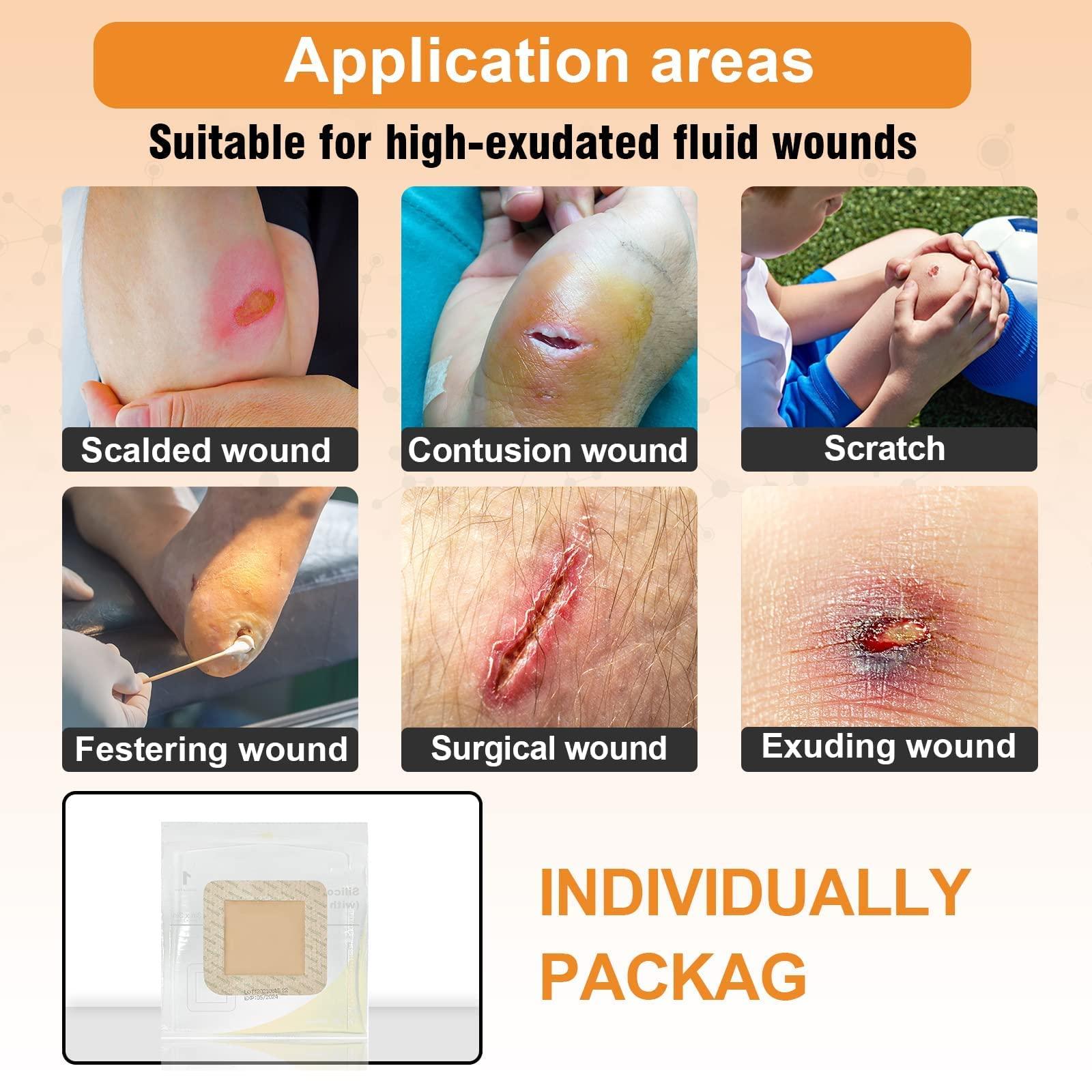 CARBOU Carbou Silicone Foam Dressing with Adhesive Gentle Border,10 Pcs 4\"x4\" and 5 Pcs 2\"x 2\"Adhesive Waterproof and High Absorbency Square Wound Care Dressing Bandage for Pressure Sore, Leg Ulcer, Diabet