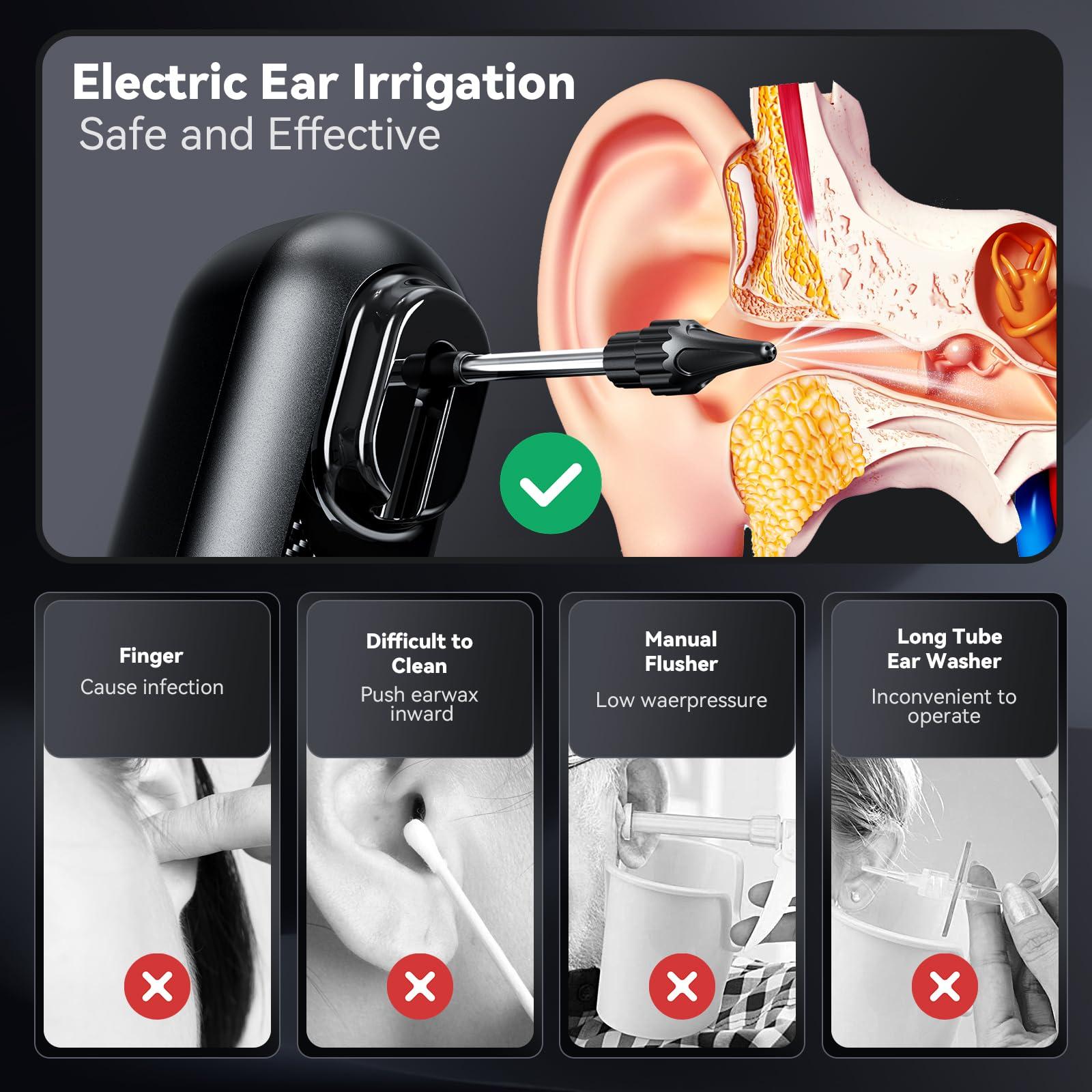 omxa omxa Ear Wax Removal Kit, Electric Water Powered Ear Cleaner, Ear Syringe Kit, Ear Irrigation Cleaner, Ear Wax Remover with 4 Cleaning Modes for Home Use Adult Kids, 10 Disposable Tips