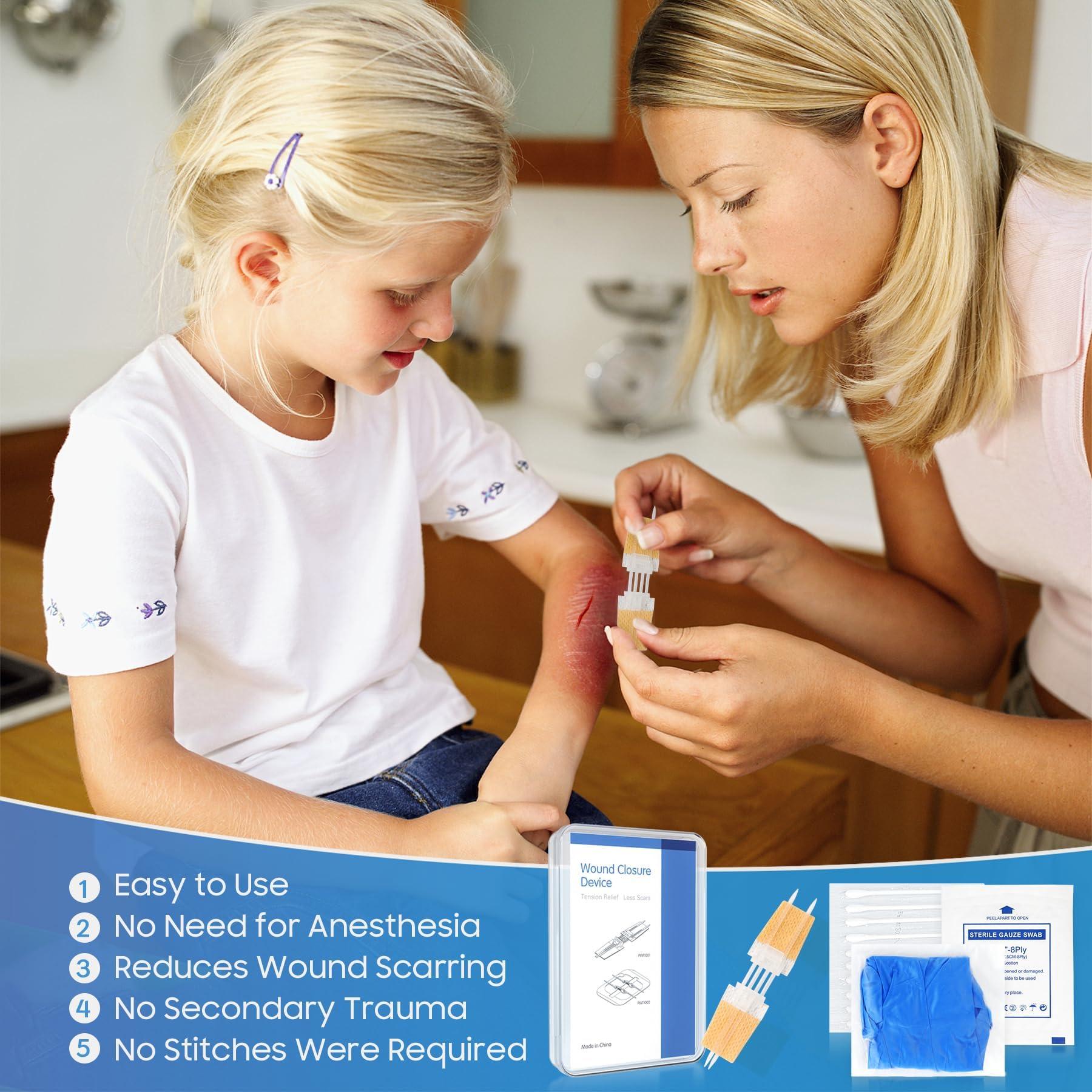 SEABIRD Zip Stitch Wound Closure Kit, Butterfly Bandages,Quick Clot for Easy Use, Surgical Quality,Emergency Laceration Closures Strips, Suture-Free Surgical Repairment, First Aid Wound Care (Yellow, 6)