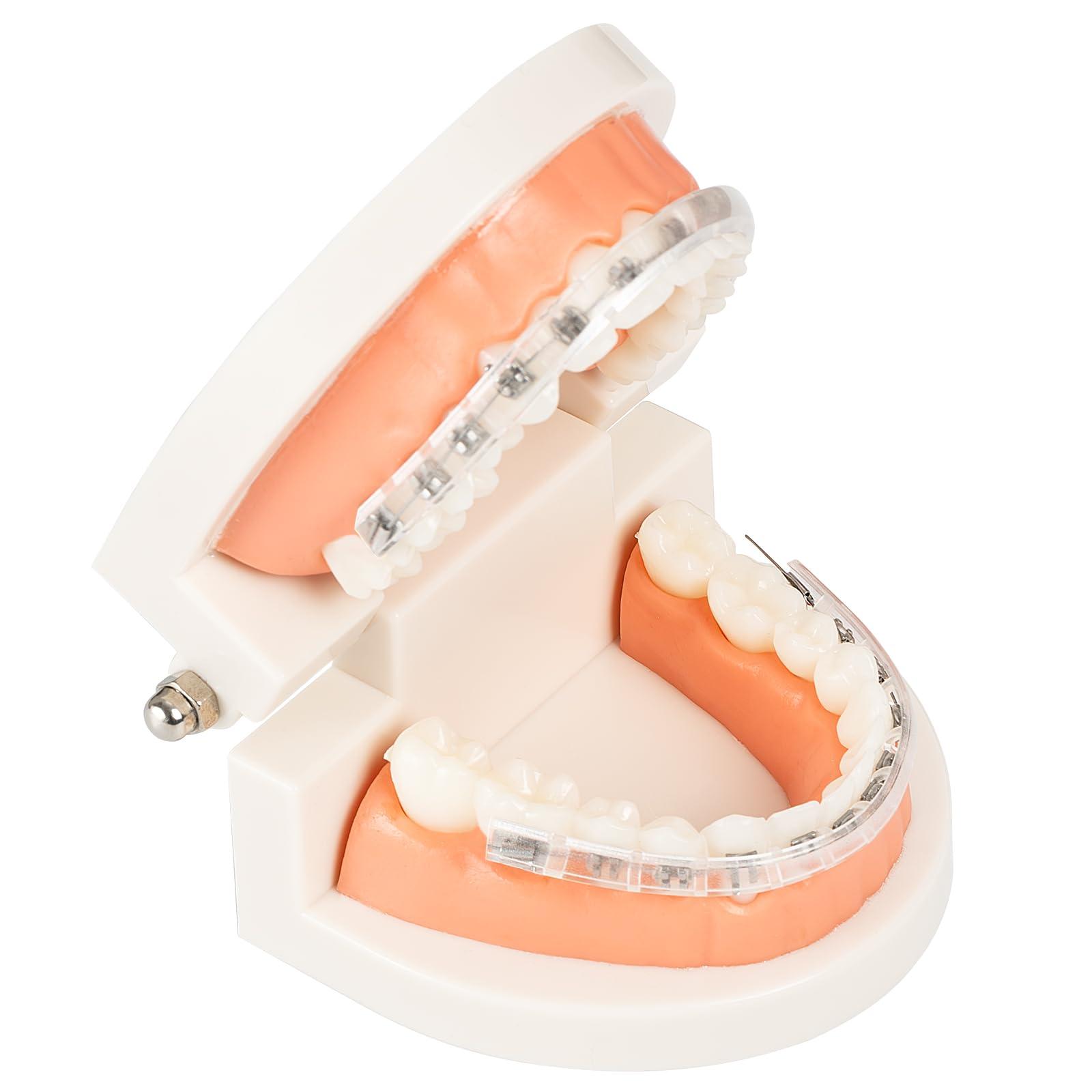 ESENHARBER Comfort Cover for Braces - Lip Protector, Lip Cushion, Mouth Guard Clear Teeth Shield Bumper for Brackets, Aligner, Dental Wax Alternative, Soft and Comfortable, in Portable Storage Case with Mirror