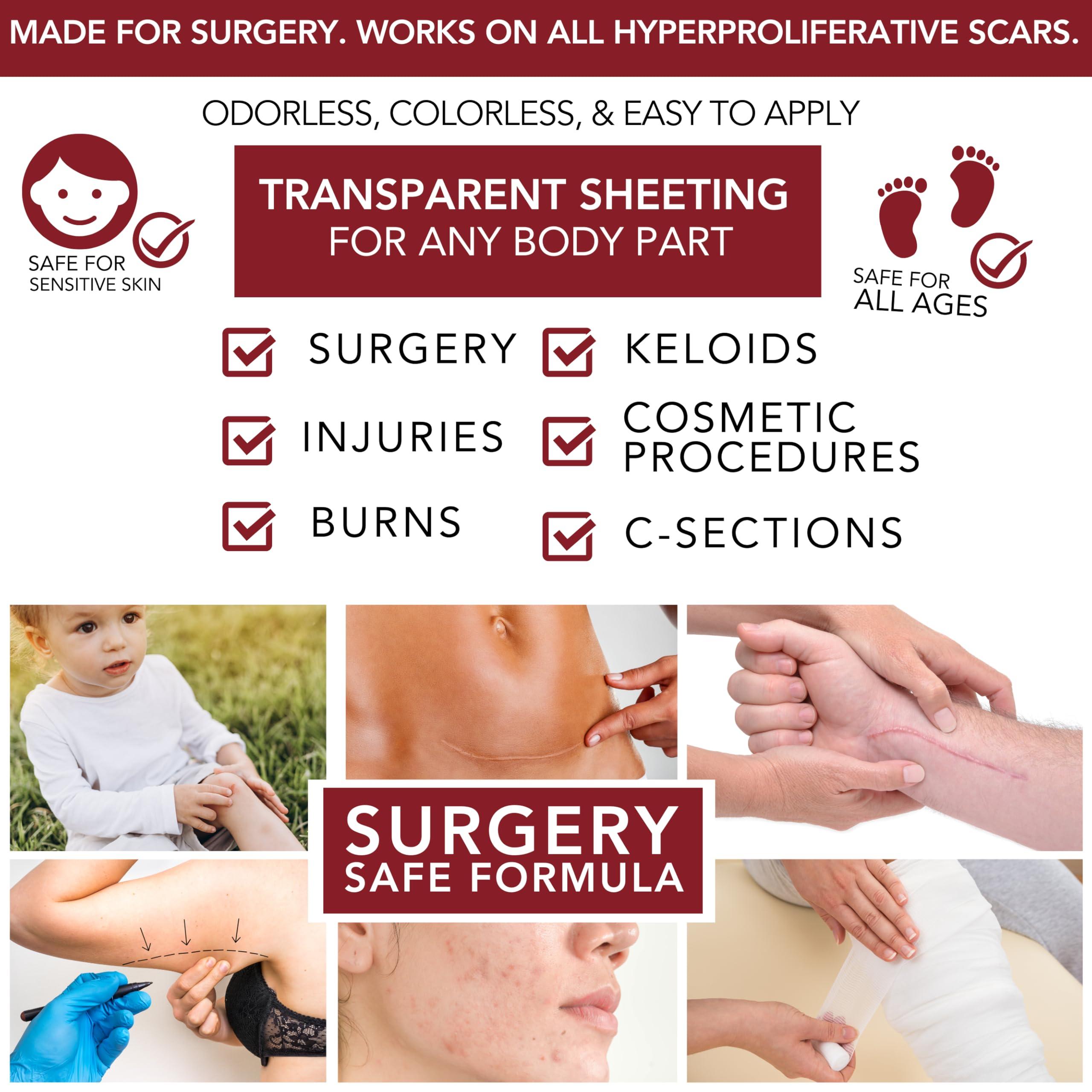 HealFast Physician Formulated Silicone Scar Gel Semi-Solid Sheeting - Advanced Crosspolymer Medical Grade Liquid Sheeting for Face, Body, Surgery, C Section, Burn, Keloidal & Hypertrophic Scars