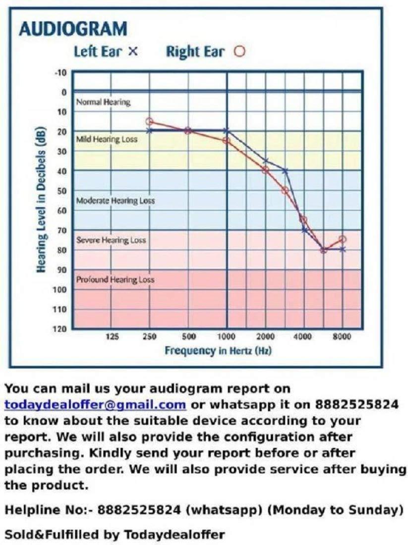 Signia Signia Connexx Primax MiniReceiver 2.0, Replacement receiver for RIC Models (Right 2_P)
