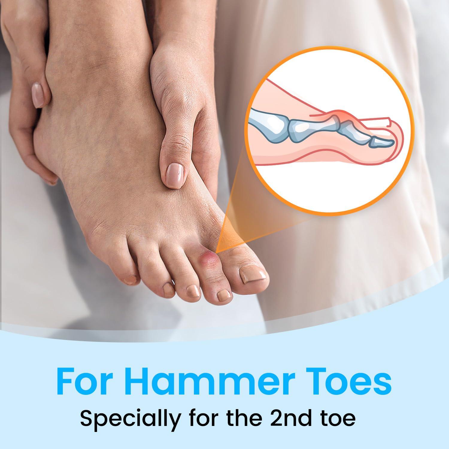 Pozpo Tech Hammer Toe Straightener Corrector Wrap for Women & Men, Hammer Toe Splint Support - 1 in package