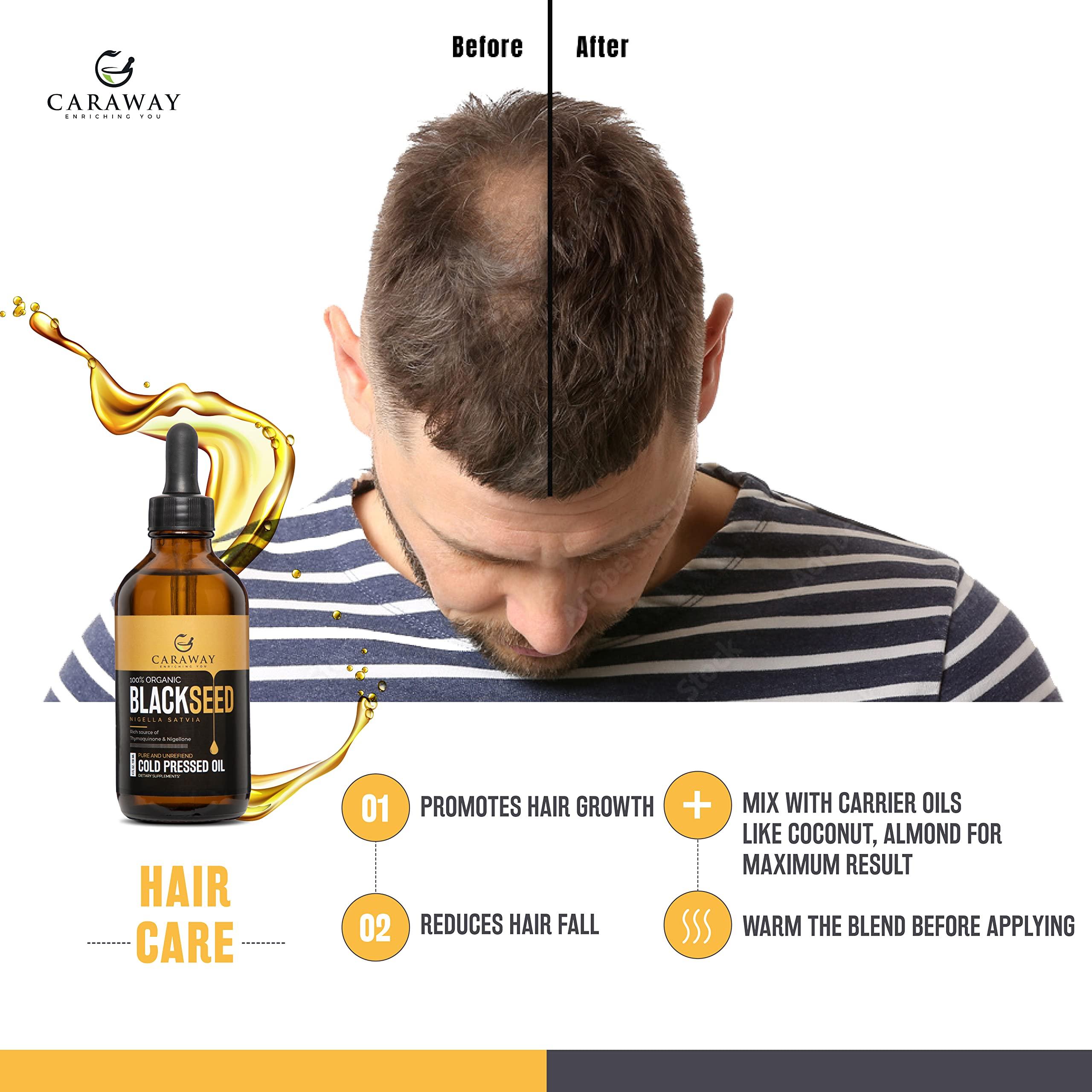 CARAWAY CARAWAY Cold Pressed Black Cumin Seed Oil - Rich in Thymoquinone for Immunity Boost, Hair Care - Glass Bottle - 4 oz / 118 ml