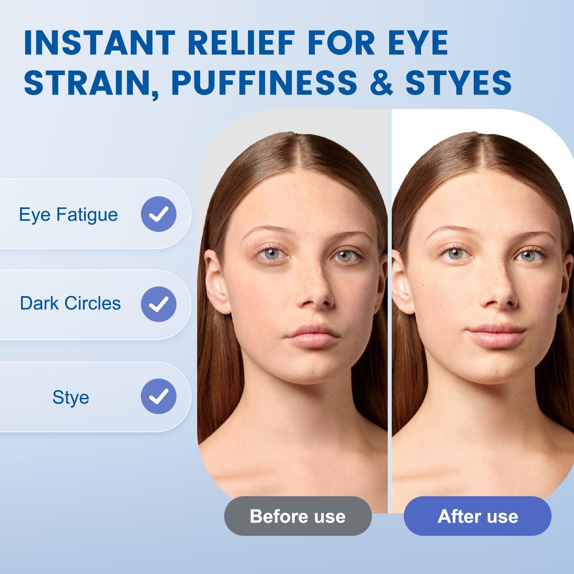 FACEMOON Migraine Relief Cooling Eye Mask- Cold Compress, Ice Cold Sleep Mask for Puffy Eyes, Dark Circles, Migraine & Headache Relief, Soft Thick Gel for Long Lasting Comfort FSA HSA Eligible-Blue